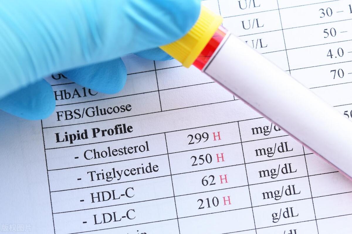 保险不是买不买而是买多少,给宝宝买保险如何买不吃亏