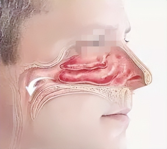 小孩总是清嗓怎么回事,孩子清嗓越来越严重了