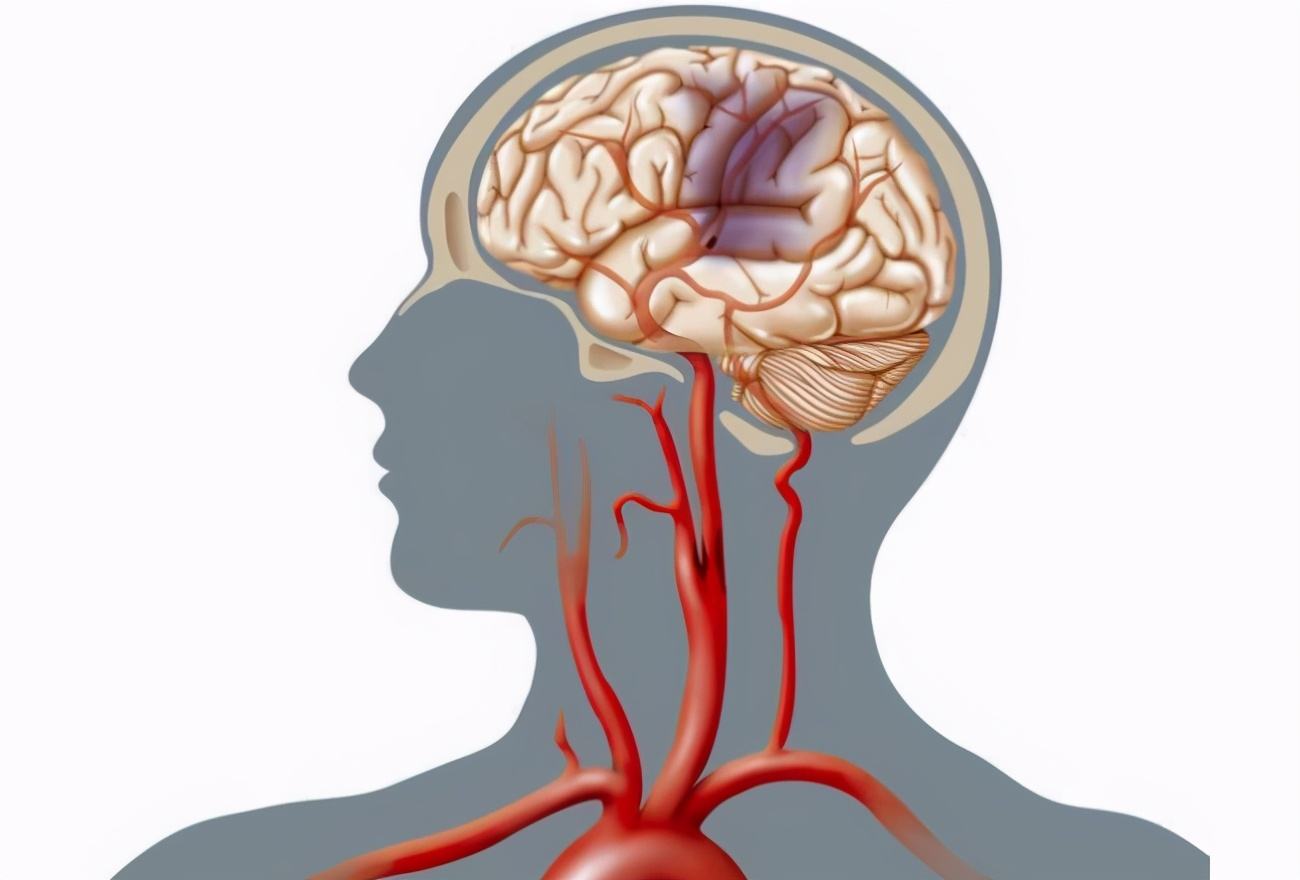 预防老年痴呆补充叶酸有效吗,维生素b12和叶酸适合脑梗病人吗