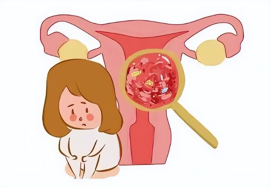 女裤上发黄有异味什么原因,女裤发黄是有妇科病吗