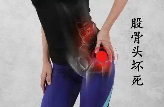 髋关节疼中医艾灸方法,髋关节疼痛中医