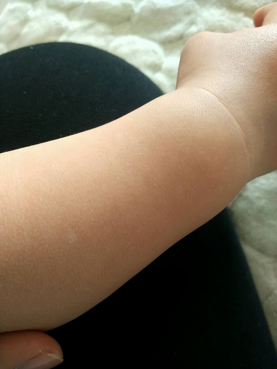 手臂上出现小白点是什么原因,手臂出现小白点用什么药膏