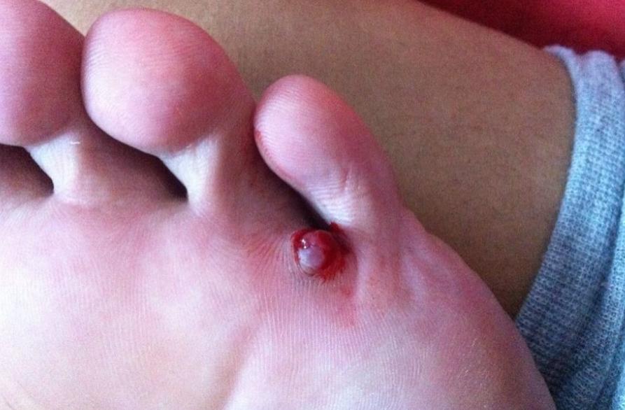 为什么非洲是艾滋病高发地？看完当地人的生活，就懂了