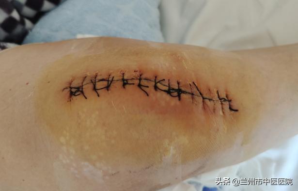 兰州市中医骨伤科医院官网,兰州市中医骨伤科医院的康复科