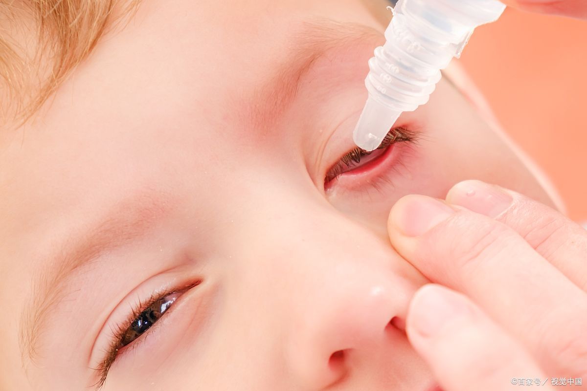 小孩突然眼屎多是什么原因引起的,三岁宝宝眼屎多眼睛肿是什么原因