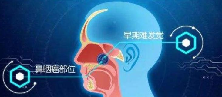 鼻咽癌精准放疗质子治疗费用,鼻咽癌首选放疗还是化疗
