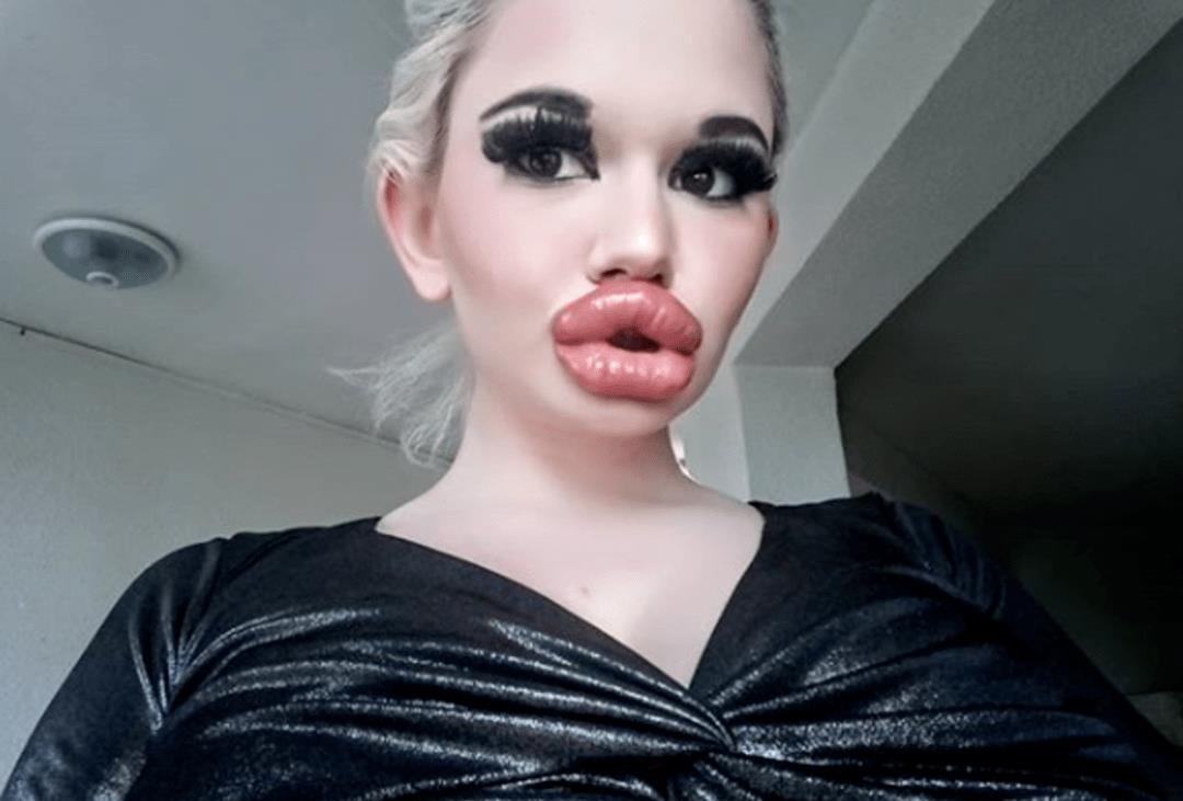 全网最厚嘴唇女网红,整容很多次网红厚嘴唇
