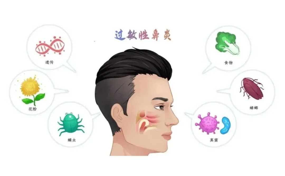 过敏性鼻炎如何舒服的度过春天,春天过敏性鼻炎科普知识