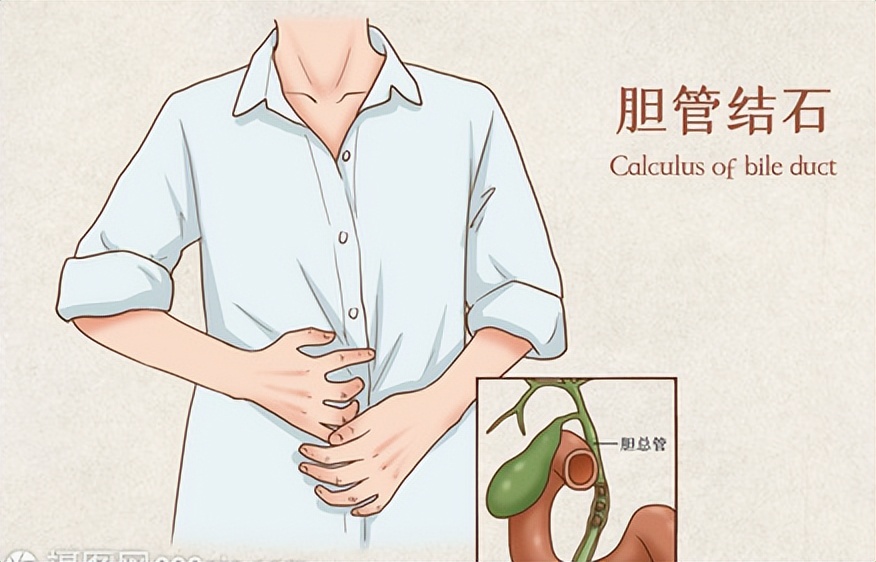 胆管炎口诀,胆管炎最怕三种水