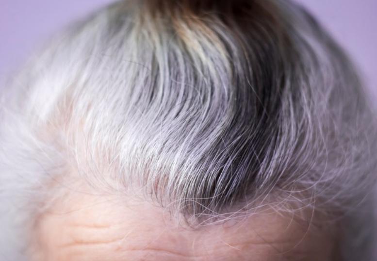 “*处私**”毛毛有啥用，要不要刮掉？由黑变白，意味着啥？建议了解