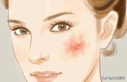 冬天来了皮肤红好痒,冬天来了脸上干燥