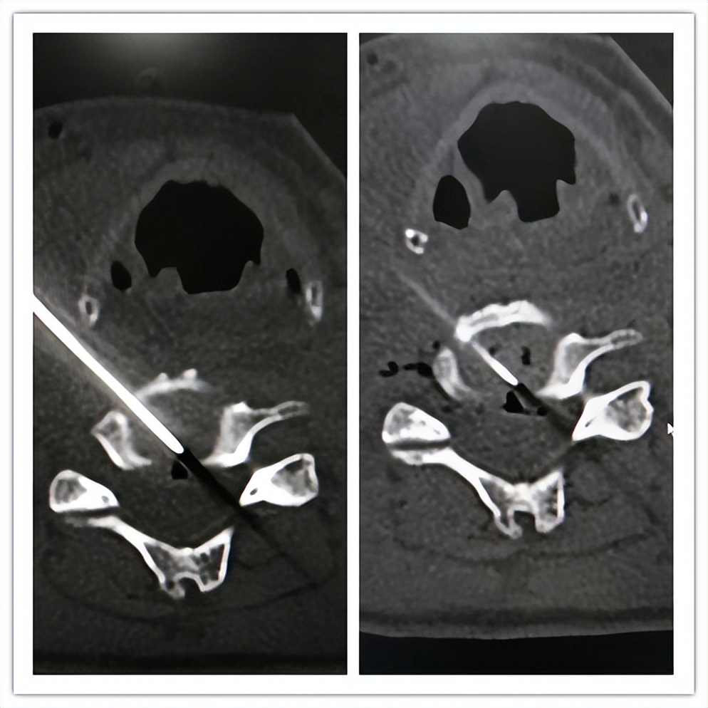 嘉善人民医院疼痛科专家,嘉善第一人民医院中医内科