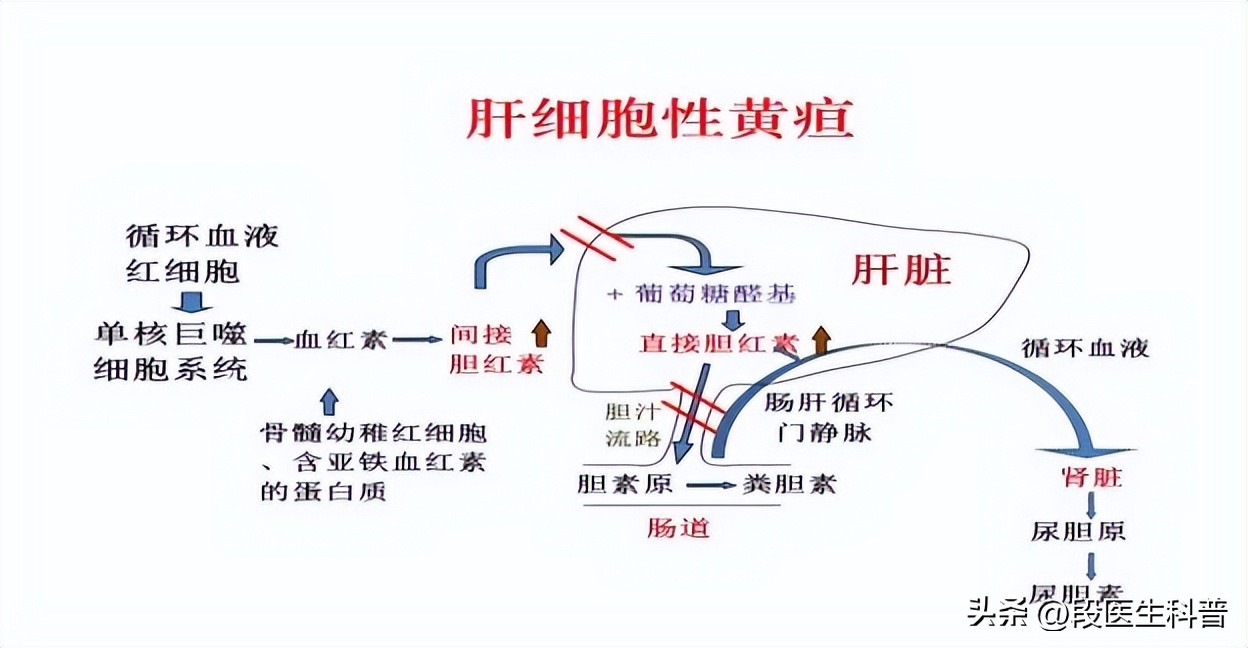 黄疸都有哪些明显症状,黄疸有哪些典型症状