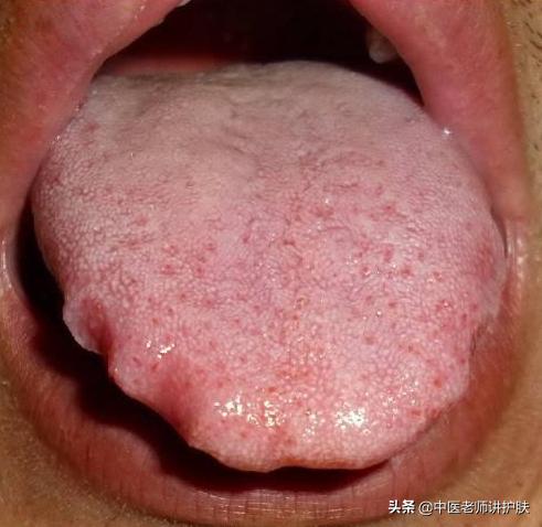 色斑也得分类别,从中医角度浅谈色斑成因,这样治疗更有效