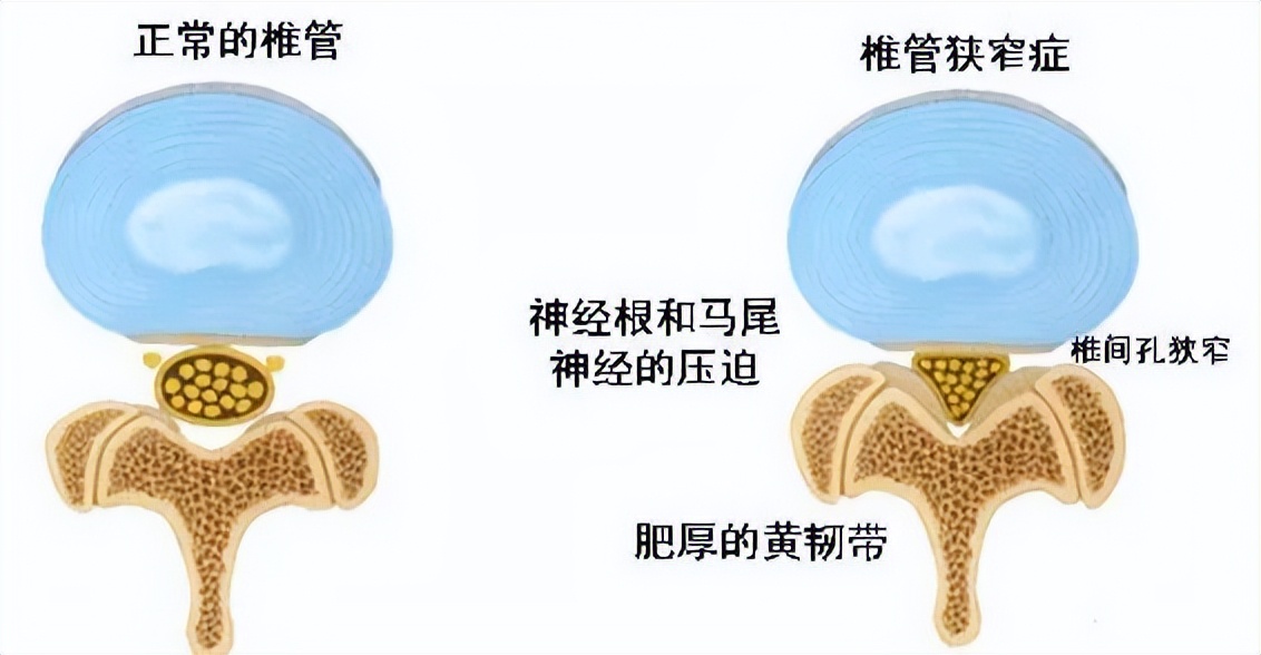 腰痛一直治不好要看神经科吗,经常腰痛要警惕四种原因