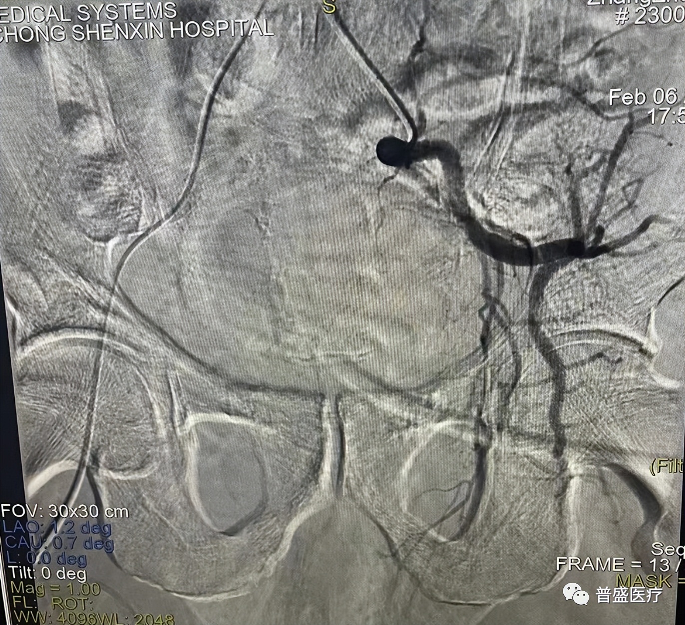 南充治肿瘤最好的医院,南充哪家医院治肿瘤好