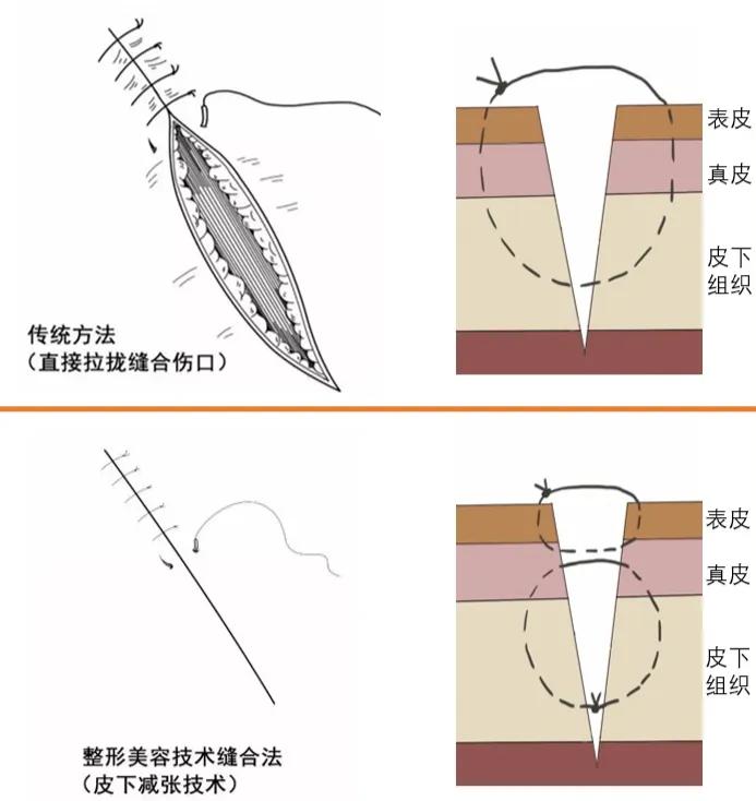 有伤别有痕面部外伤还需美容缝合——邯郸市口腔医院医学美容科副主任王璞