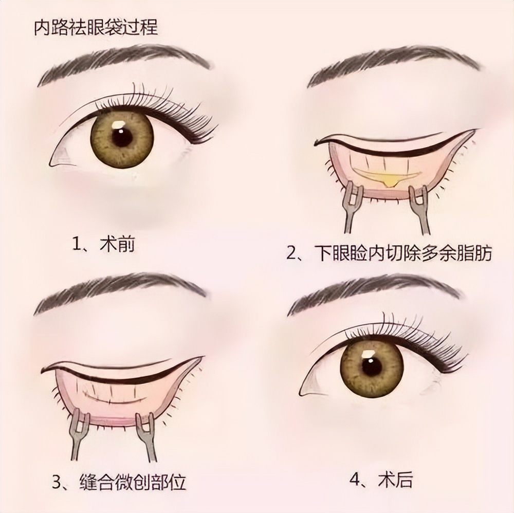 什么干货补眼强肾,拿什么来拯救我的眼袋