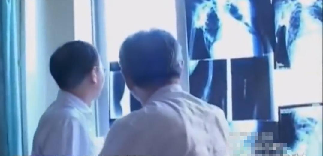 故事：大连39岁姑娘患怪病，皮肤坚硬宛如石膏，专家结论希望渺茫