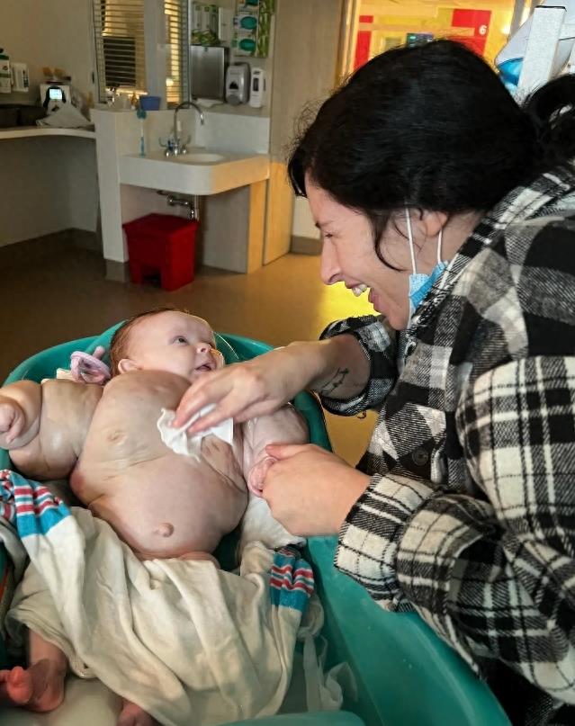 美国婴儿女孩,美国女婴身体患绝症