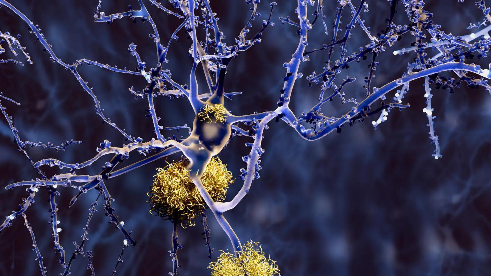 “旁边有人，就会尿不出来”是怎么回事？是病吗？听听医生怎么说