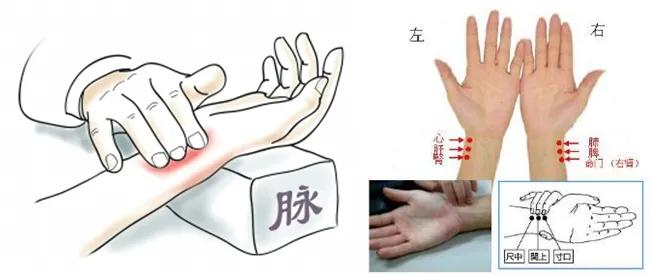正常脉诊歌诀,脉诀和脉象的辨别方法