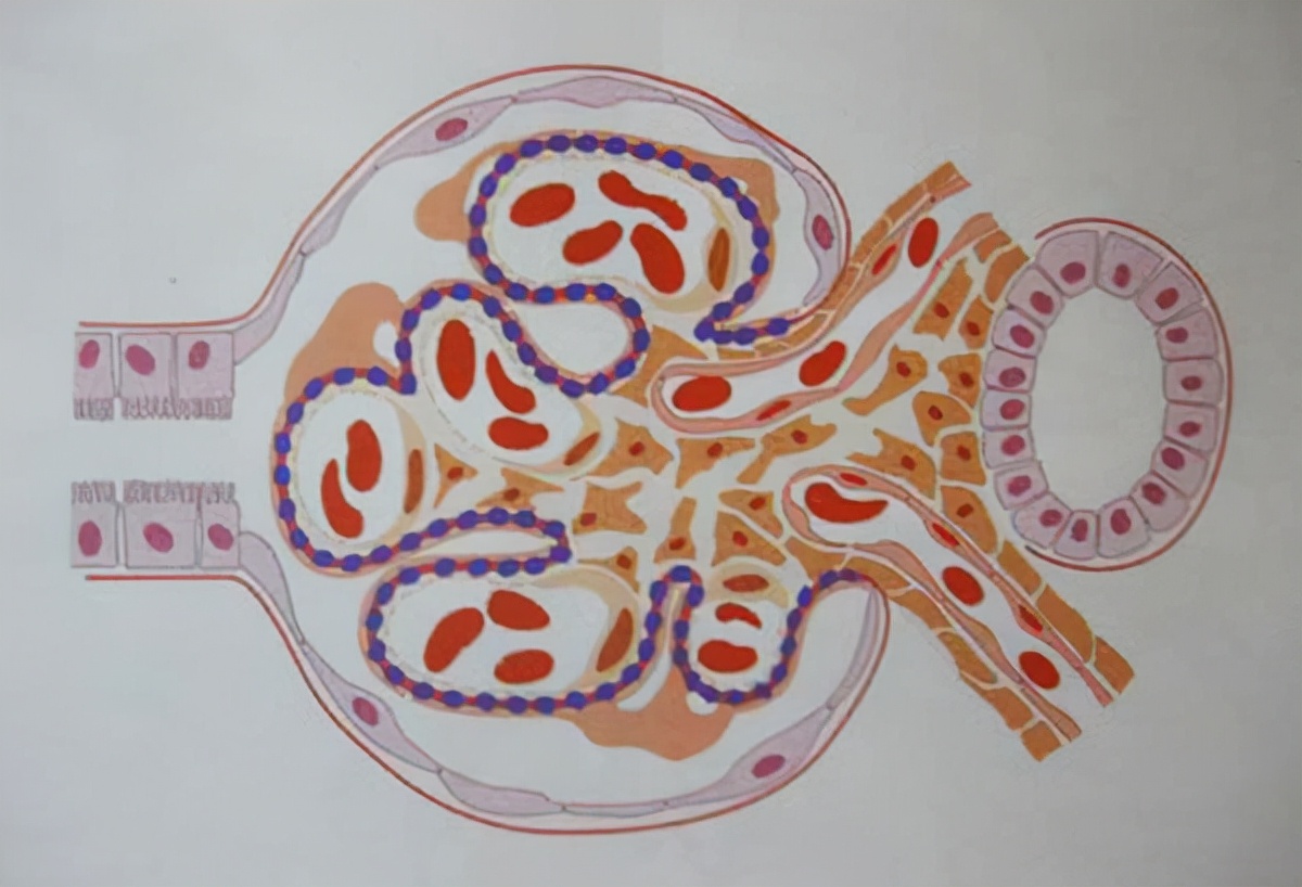 膜性肾病中药能治疗吗,膜性肾病尿蛋白反复怎么回事