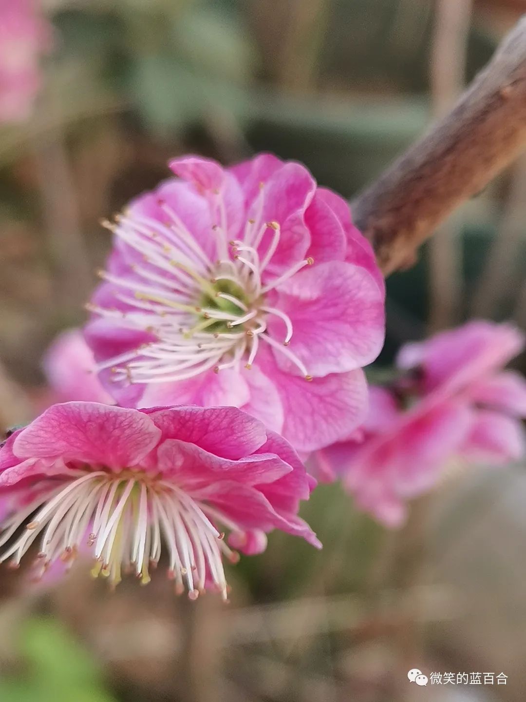 生命的美好，源于人间烟火里的那些认认真真