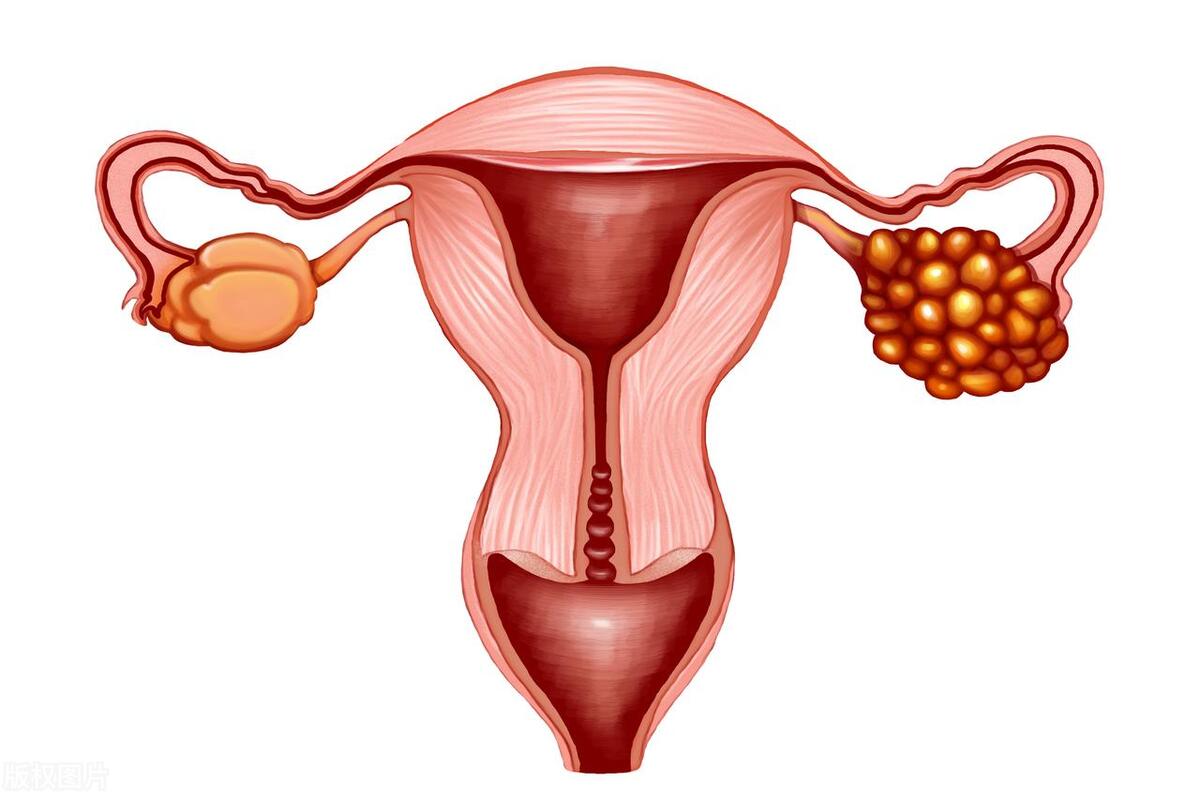 人工流产并发症,人工流产常见并发症有哪些