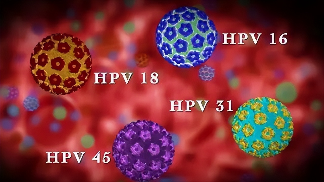 宫颈癌患者有什么护理方法,30岁女性宫颈癌治疗