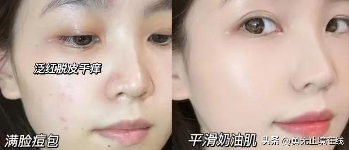 热门水乳真实测评｜避免智商税高性价比保湿美白修复水乳套装推荐