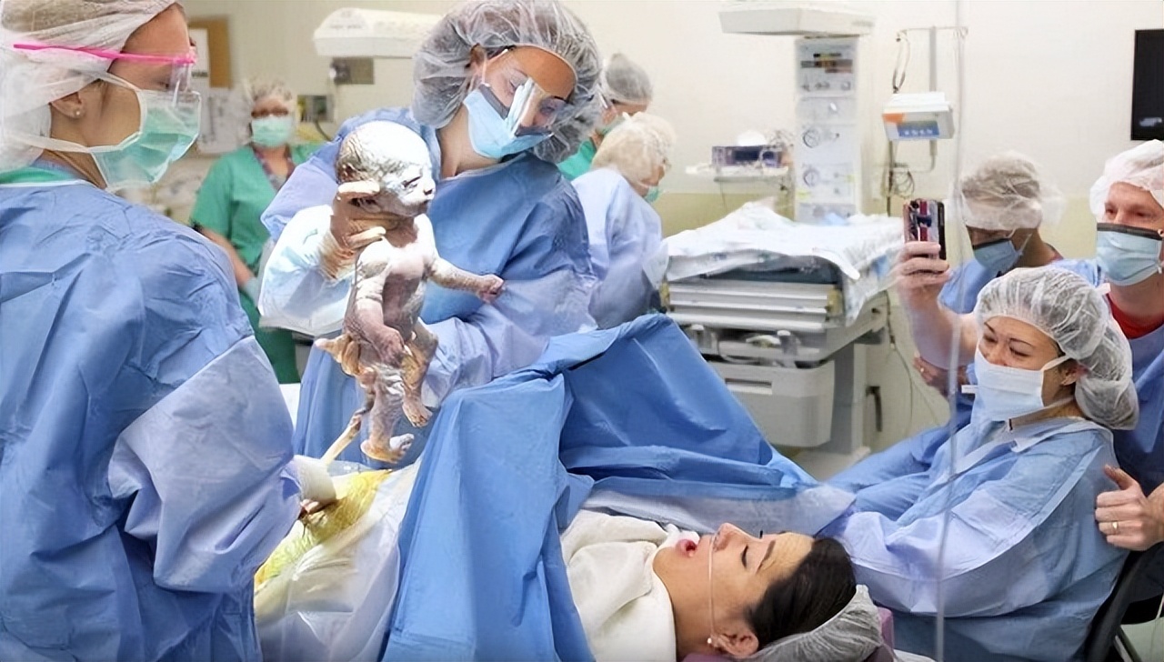 美国一夫妻诞下双胞胎,美国姐妹俩生下双胞胎