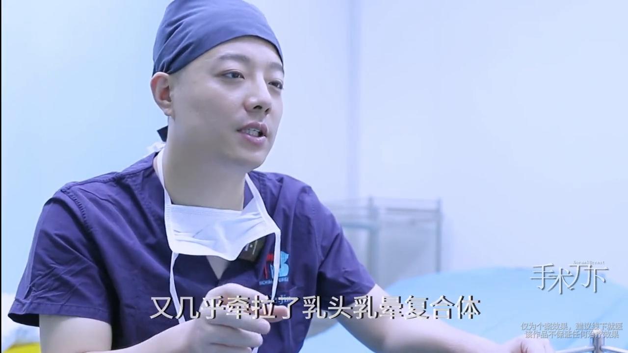 乳房肥大+下垂，2小时解决女士“”乳房老化“”的问题#...