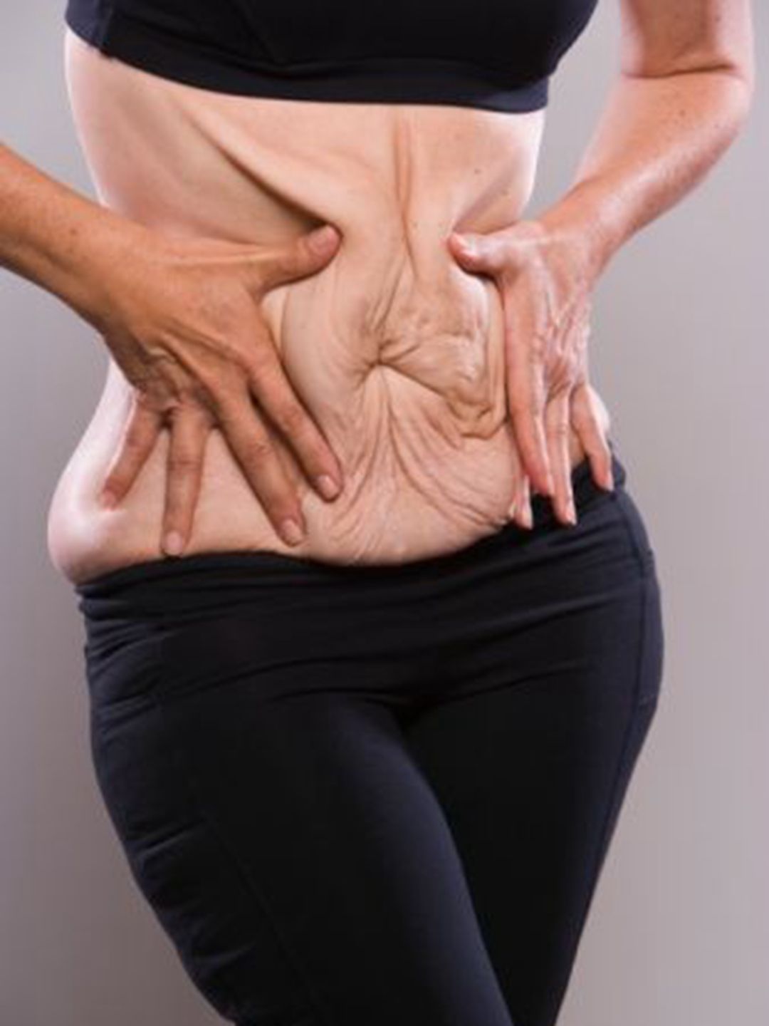 减肥快皮肤松弛需要多久能恢复,减肥皮肤松弛的原因和改善方法