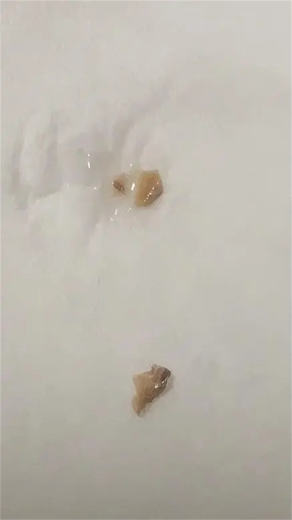 学生党牙黄怎么刷才能刷干净,白牙小妙招1天见效