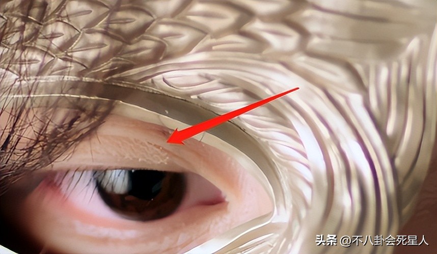 假双眼皮的明星,明星的假脸