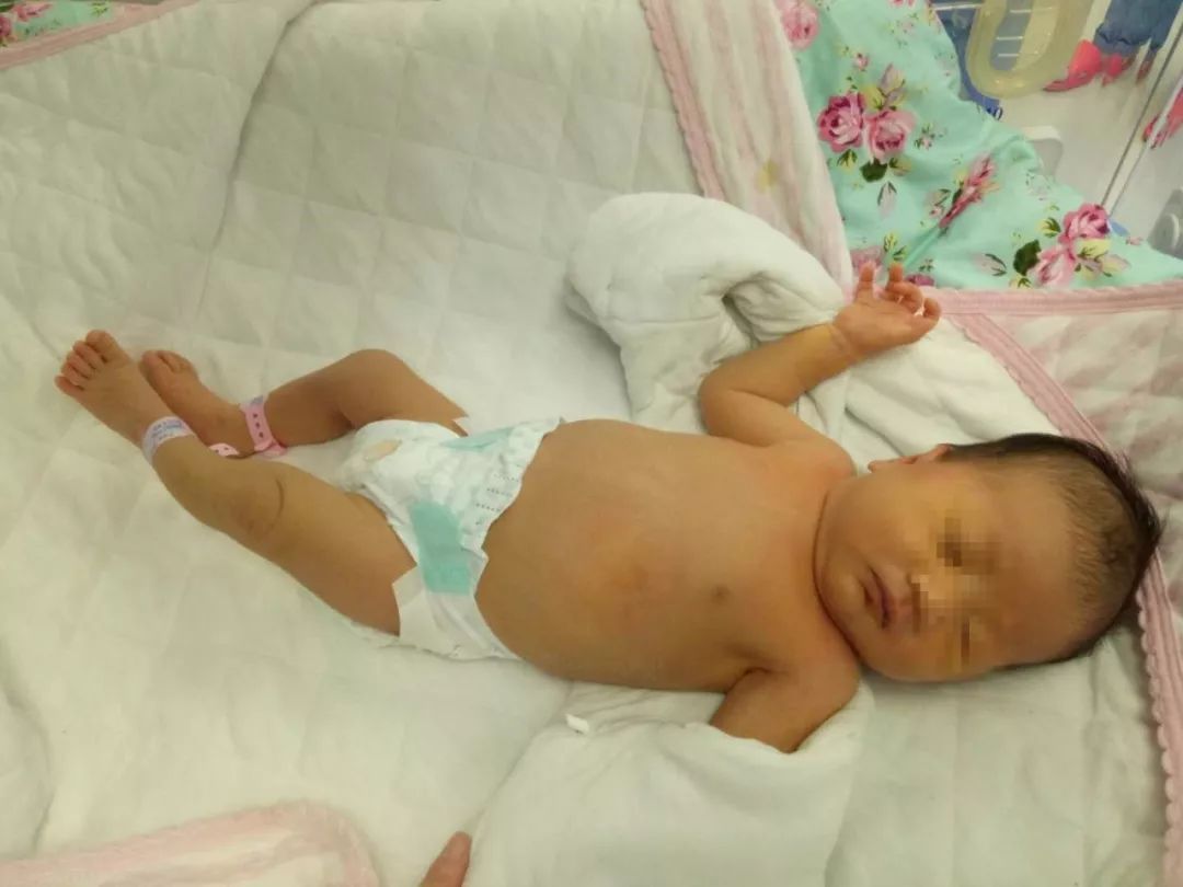 新生儿体温偏低是怎么回事,新生儿体温低有什么影响