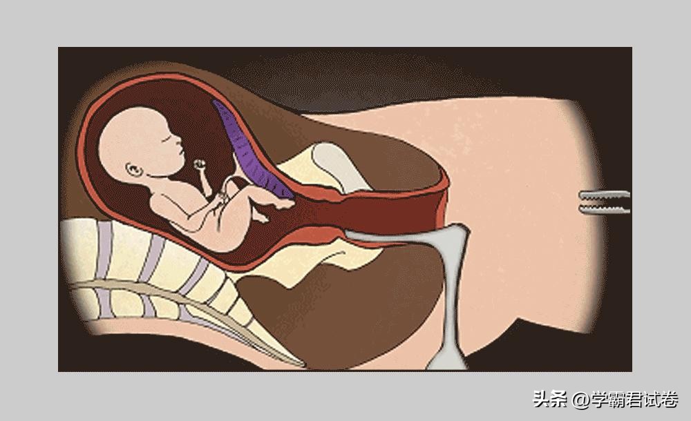 为何总有女生会意外怀孕？或许是安全期惹的祸（漫画）