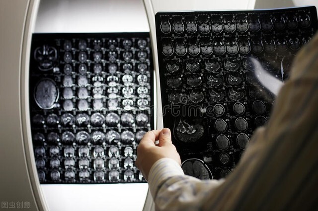 核磁共振迎来国产替代,磁共振可以替代增强ct吗