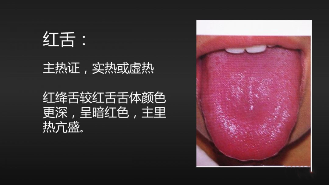 舌诊辨证和精准用药,中医诊病无需诊脉和观舌象靠谱不