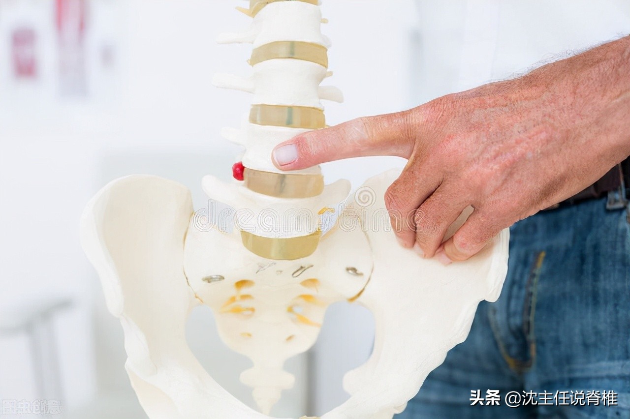 腰痛腰椎间盘突出防治四要点,腰椎间盘突出症腰痛有什么偏方