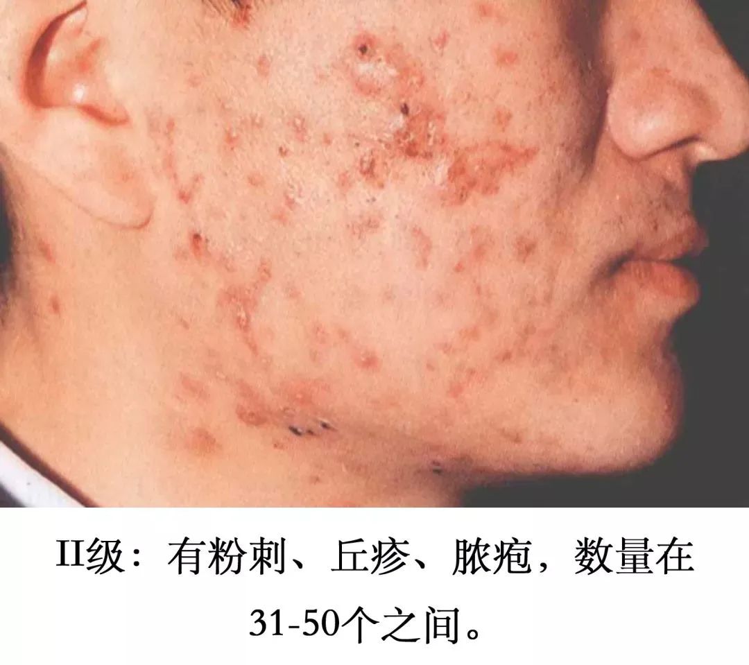 养成干净脸的最好方法,养成干净脸