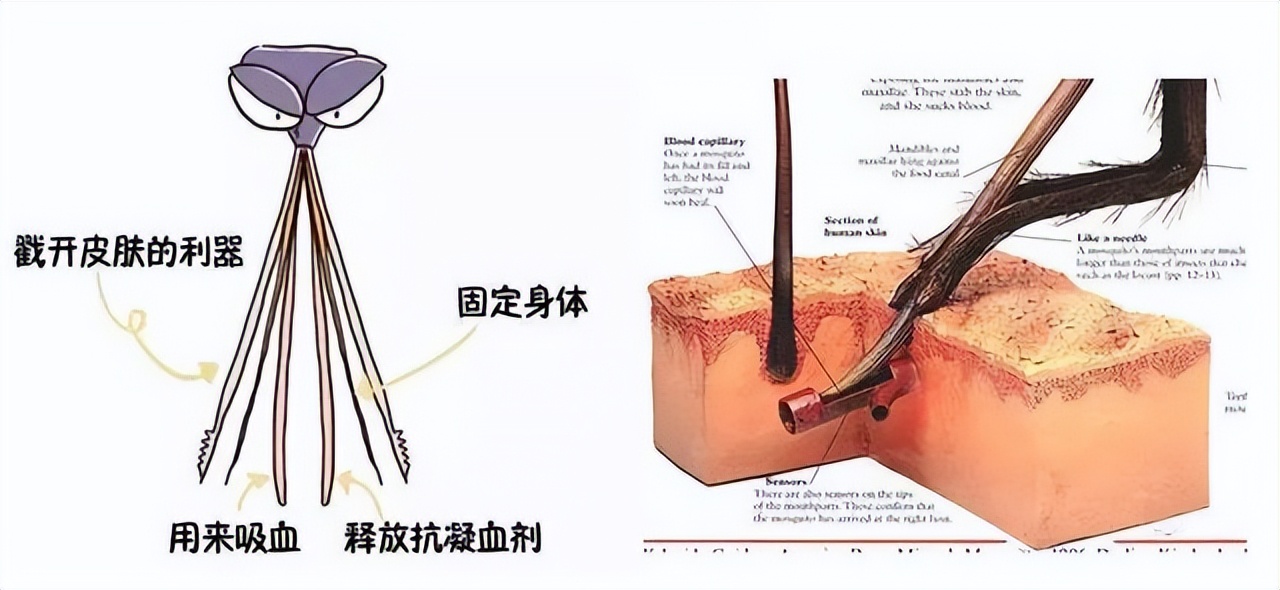 蚊子最怕的3个小妙招,快速让蚊子消失这小技巧