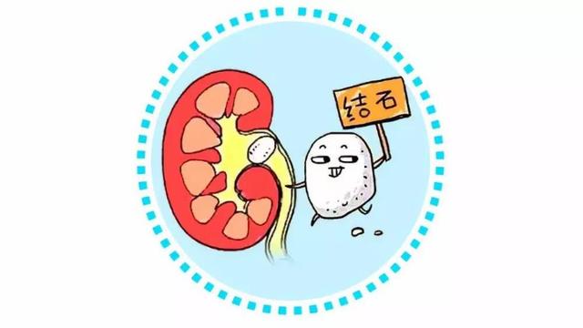 一味中草药排结石,一味草药排结石