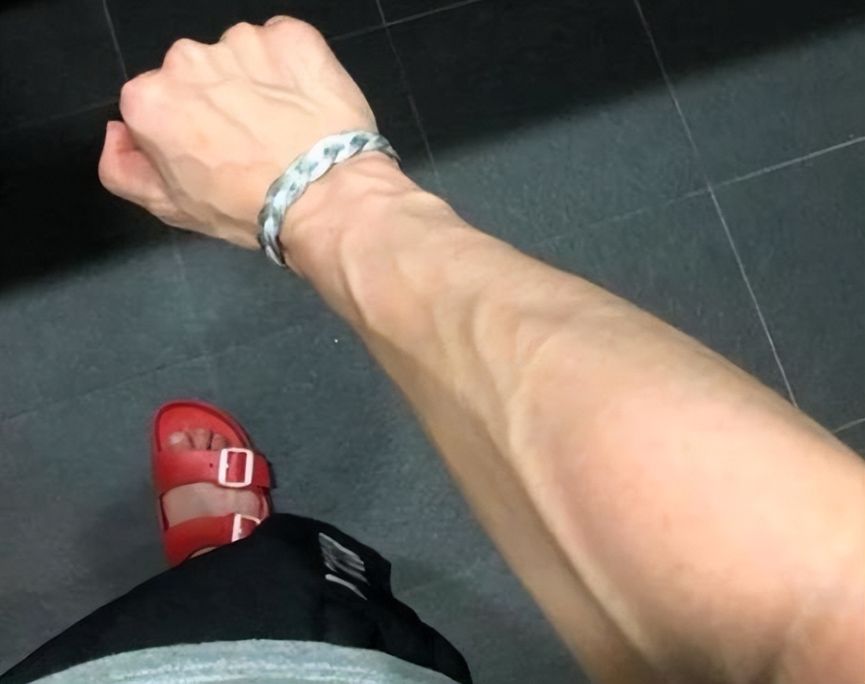 人手臂上的青筋看得出吗,手臂爆青筋是天生的吗