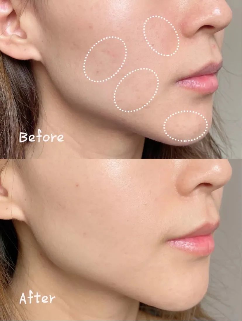 倩碧302黑色素干预科技,倩碧镭射美白精华vc含量