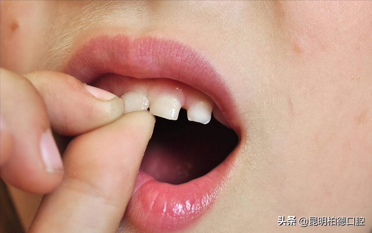 成年了下牙齿有一点点松动怎么办,牙齿的那些事