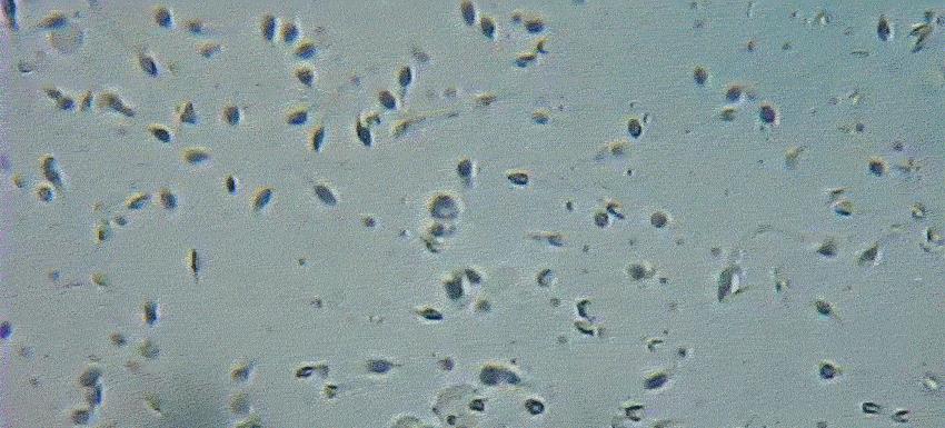 精子的活动轨迹讲解,精子的轨迹分析