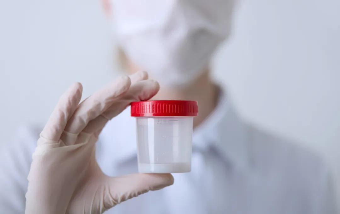 精液健不健康，看这3点就知道！事后记得花几秒自查