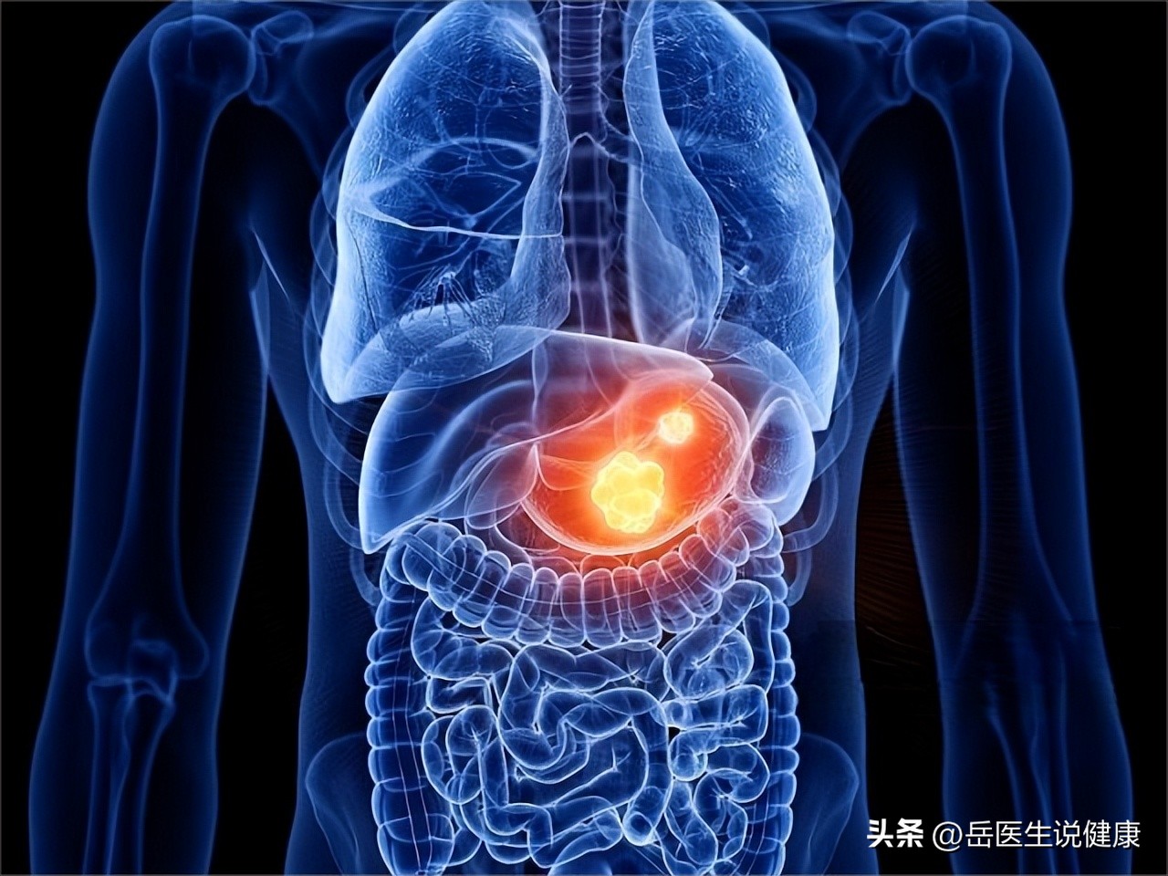 胃病不需要吃胃药吗,什么样的胃病吃胃药没用